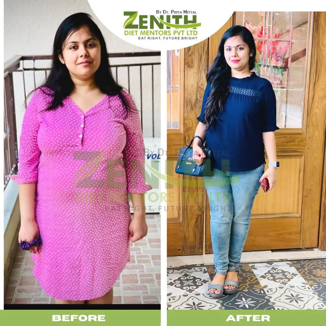 Dt. Priya Mittal- Expert Dietician & Nutritionist in NCR – Zenith Diet ...